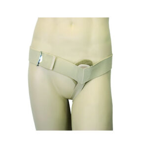 Κηλεπίδεσμος